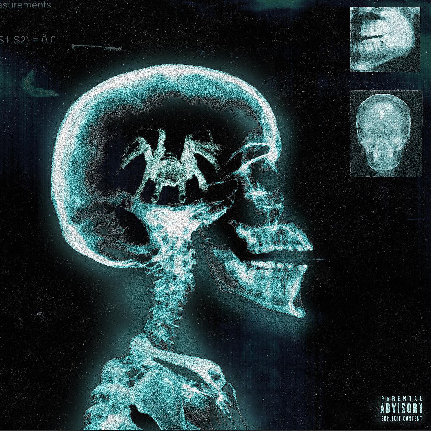 Danny Towers - Paraplegic (feat. Woop)