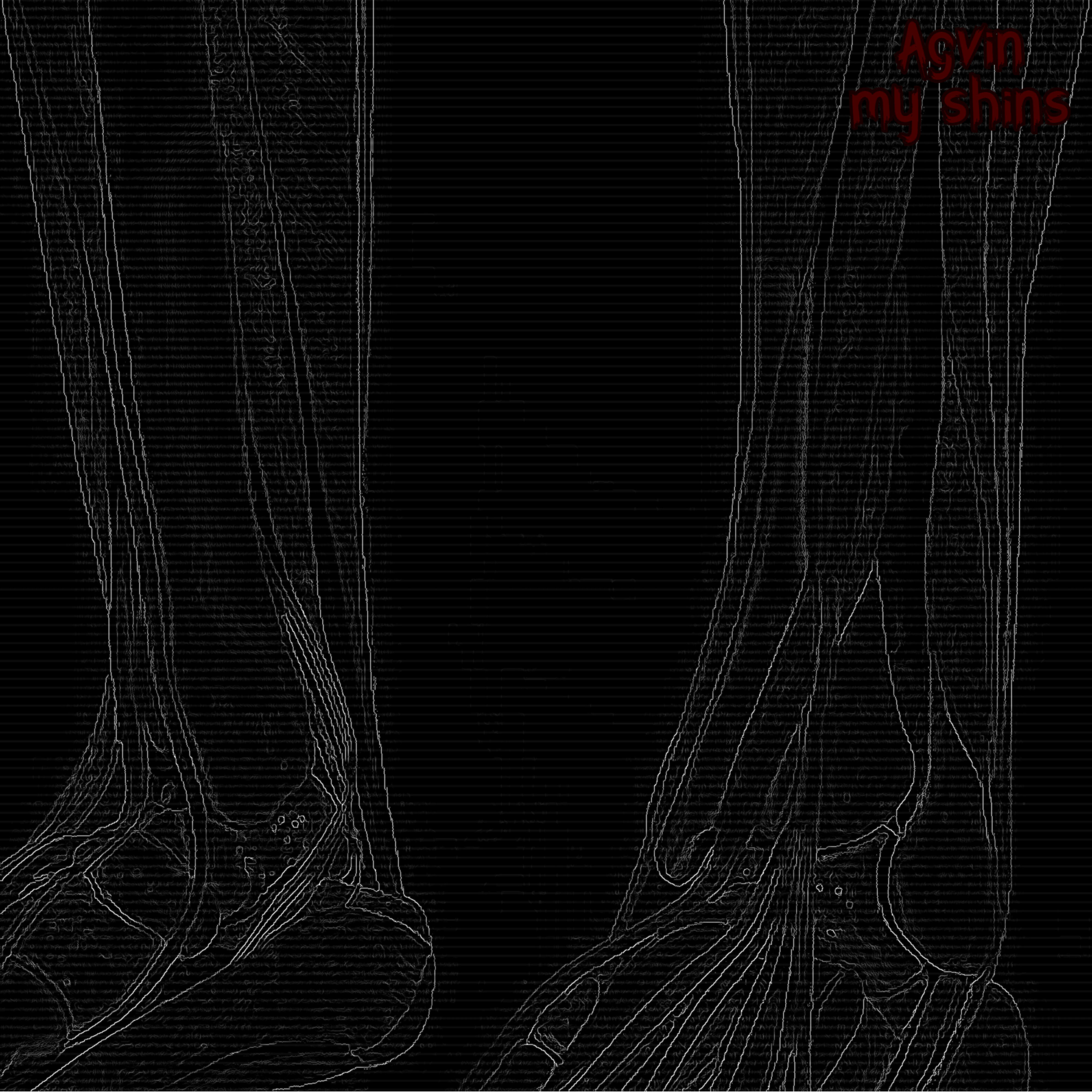 Agvin - My Shins