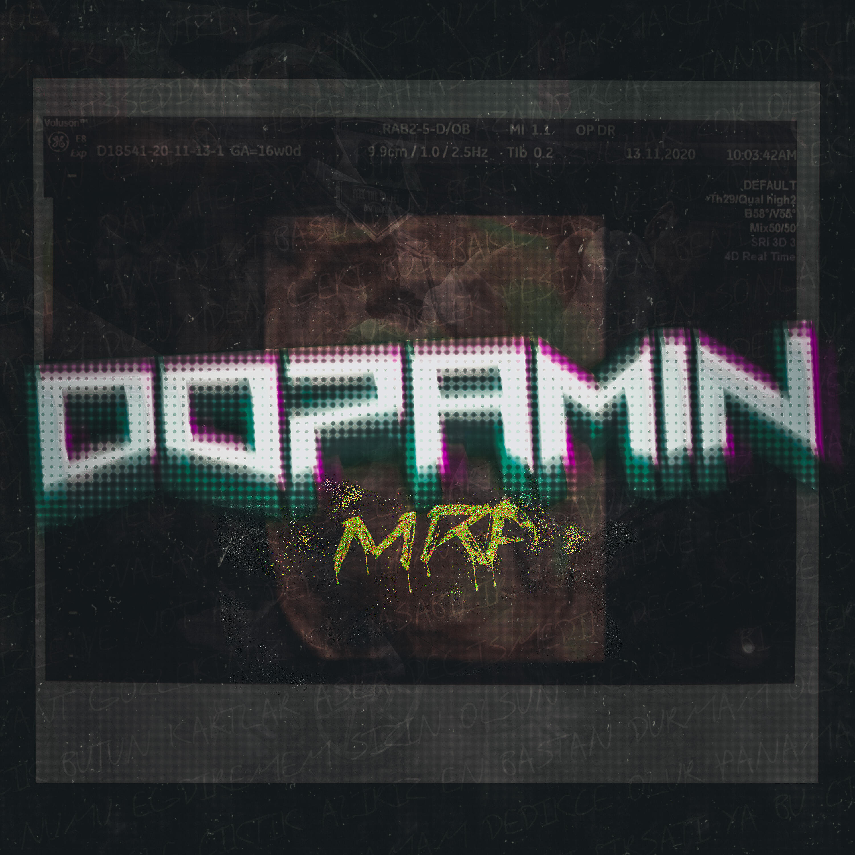MRF - Dopamin