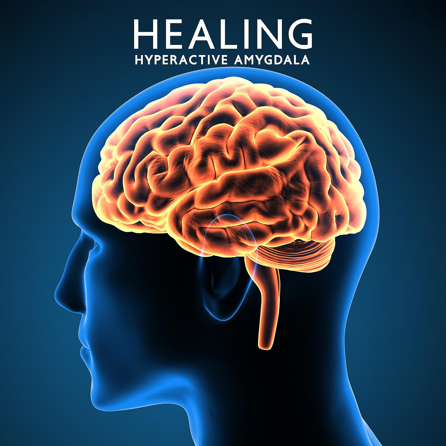 Постер альбома Healing Hyperactive Amygdala: Cure Anxiety Panic Attacks, Nerve Regeneration (Brain Wave Therapy Music)