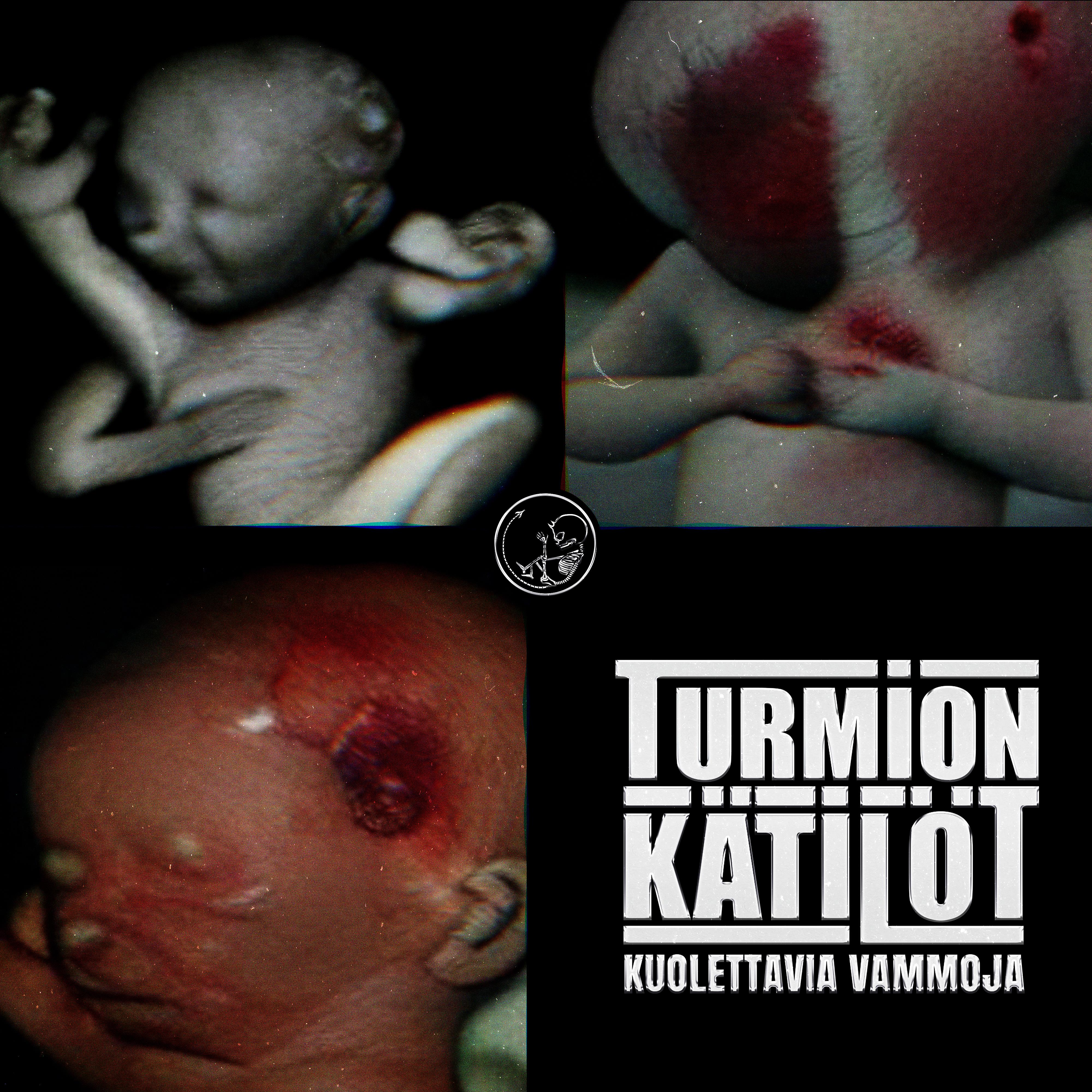 Постер альбома Kuolettavia Vammoja