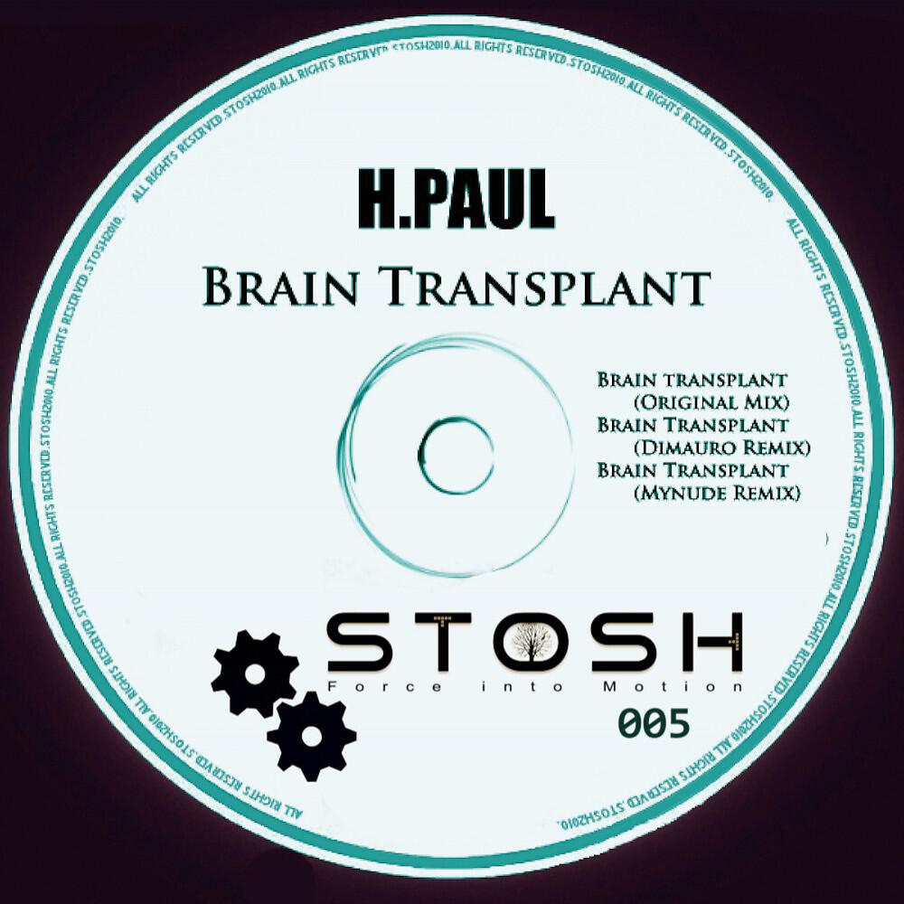 H.Paul - Brain Transplant (Dimauro Remix)