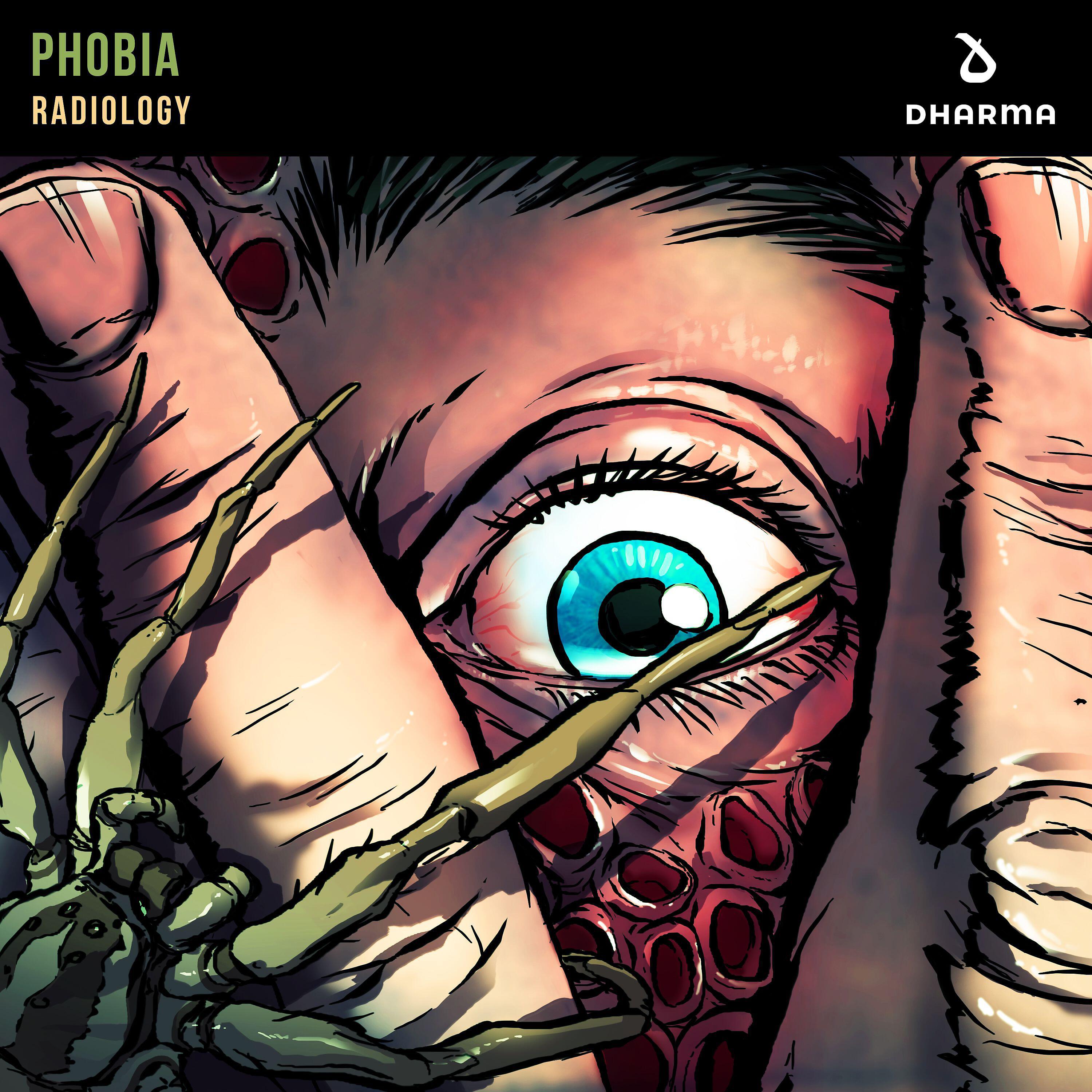 Radiology - Phobia