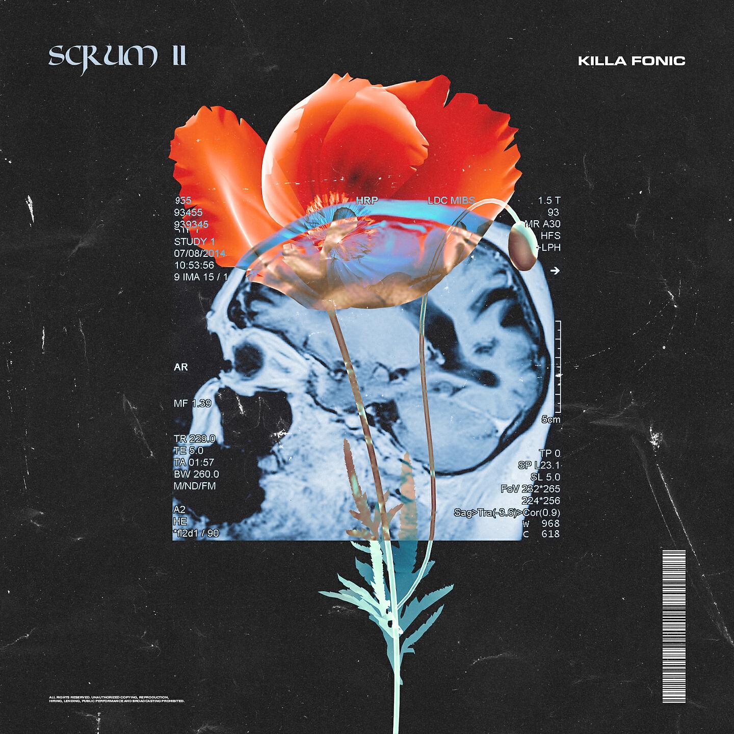 KILLA FONIC - Scrum 2