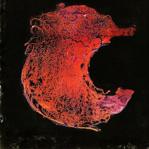 Ale Mania - Robust Universe