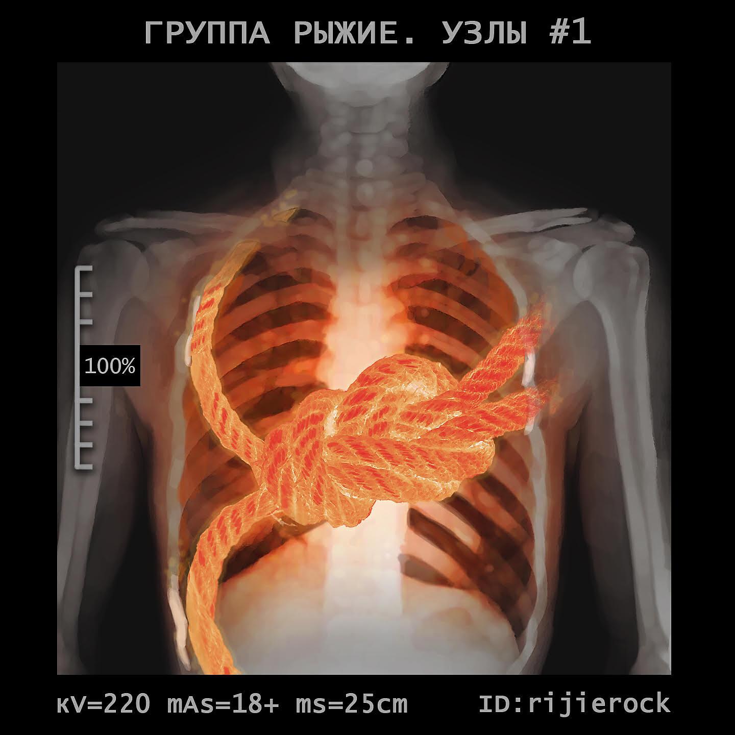 Группа Рыжие - Гулять-целоваться