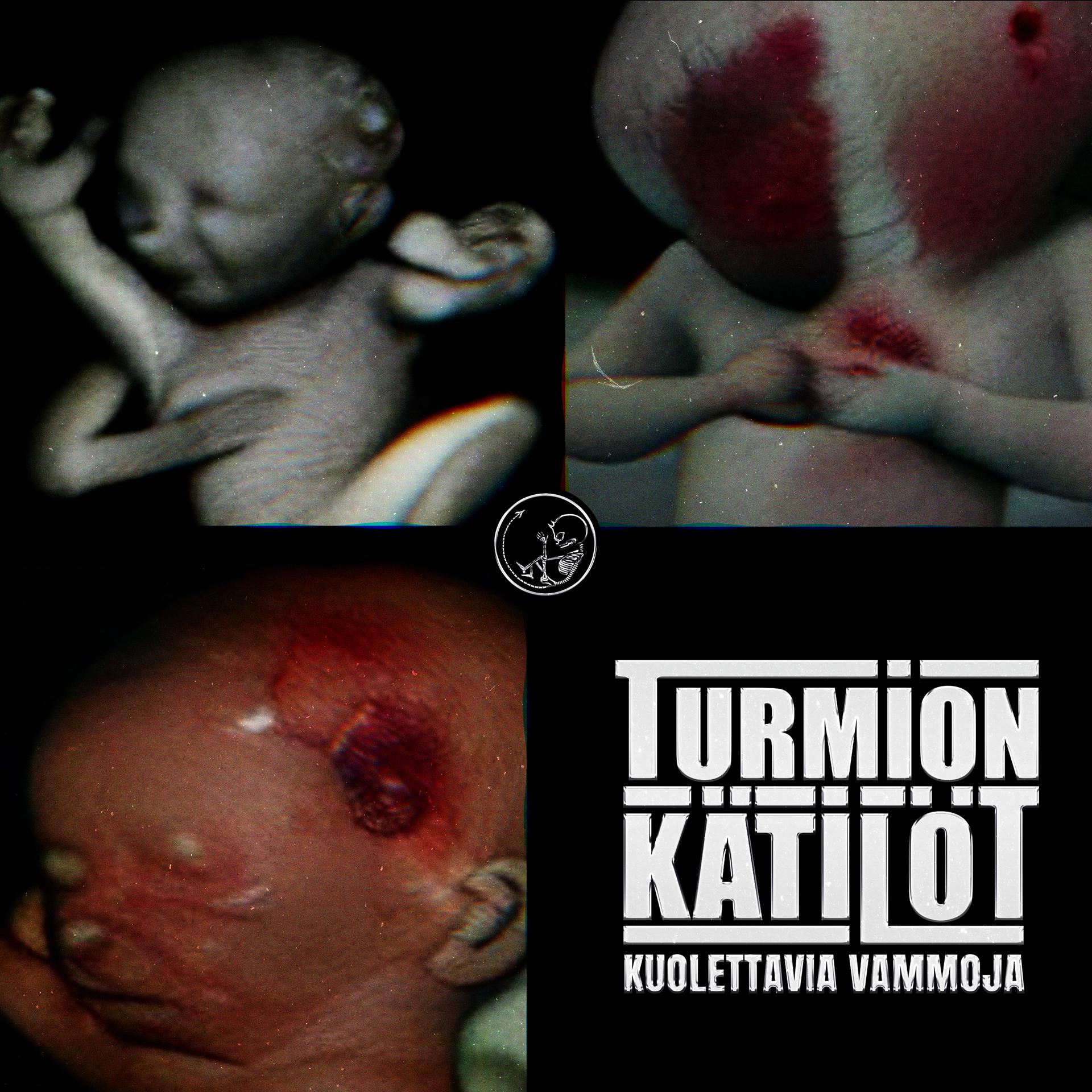 Постер альбома Kuolettavia Vammoja